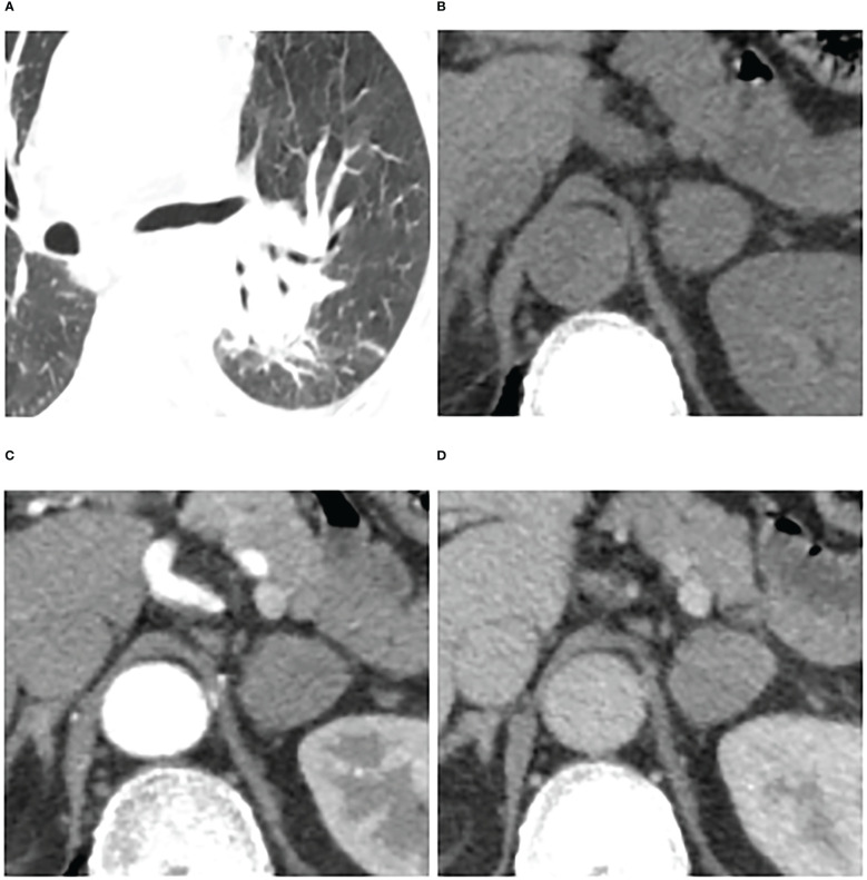 Figure 6