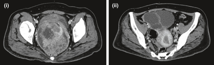 FIGURE 1