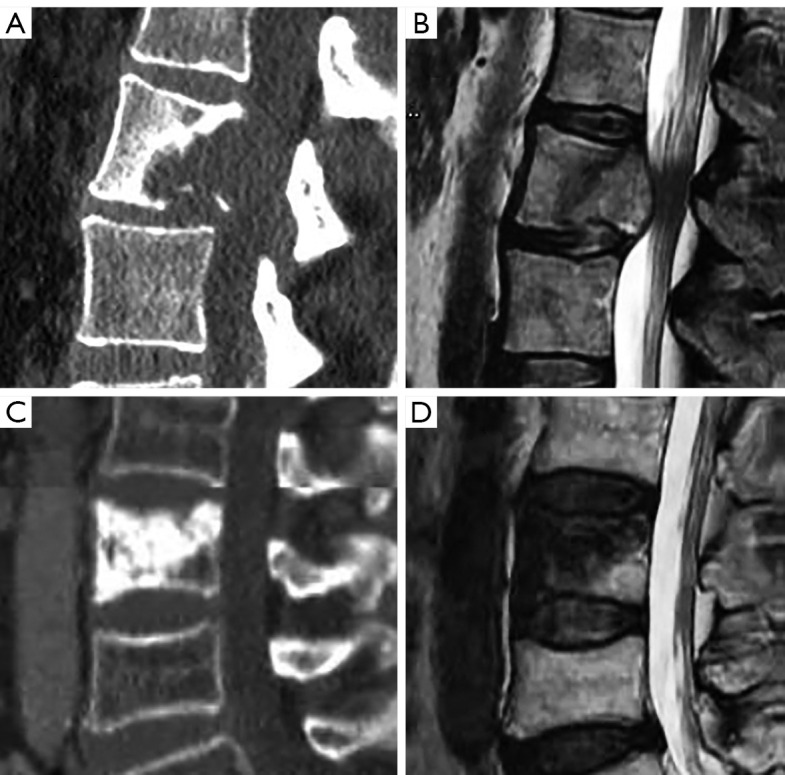 Figure 33