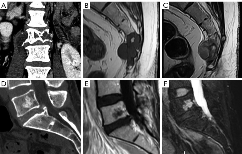 Figure 32