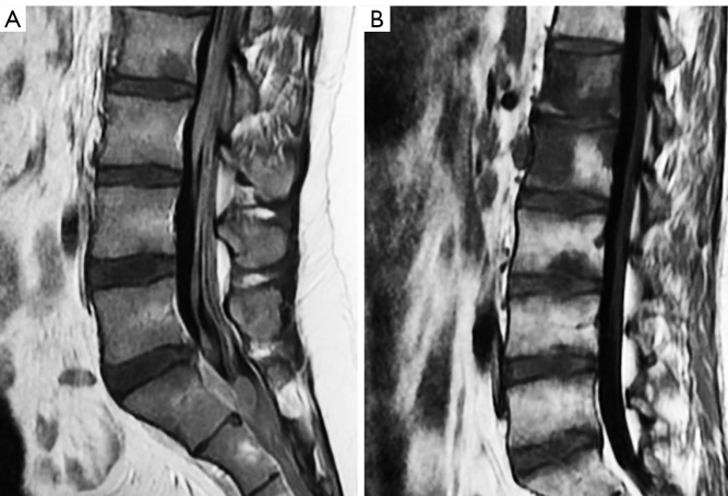 Figure 35