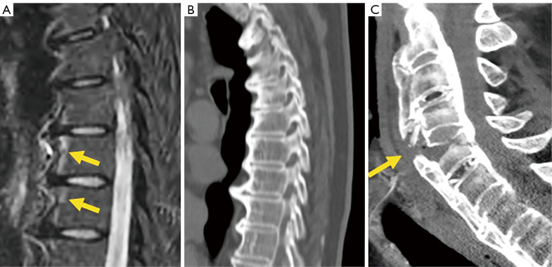 Figure 16