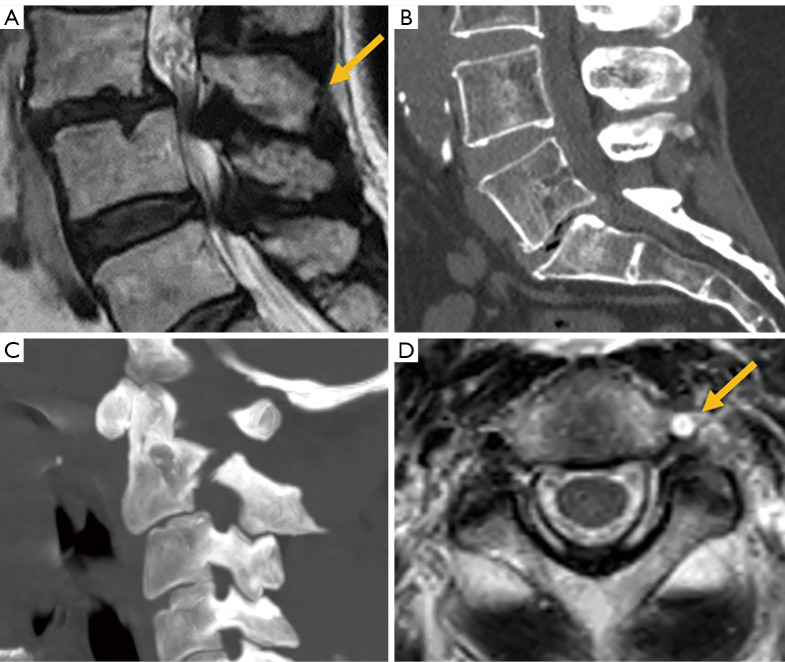 Figure 23