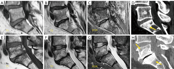 Figure 15