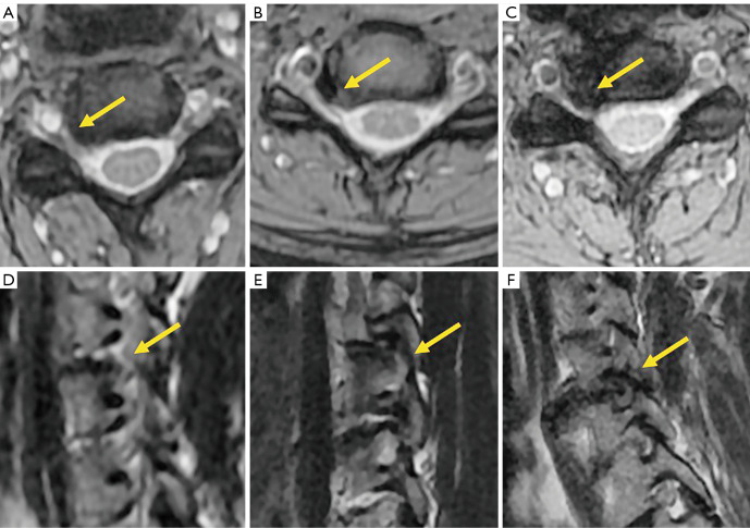 Figure 20