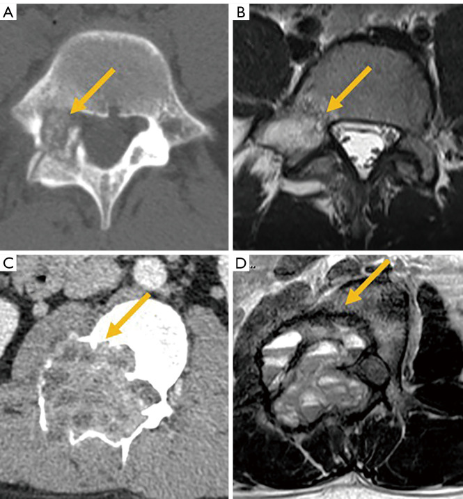 Figure 30