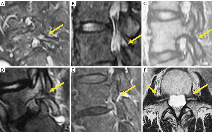 Figure 21