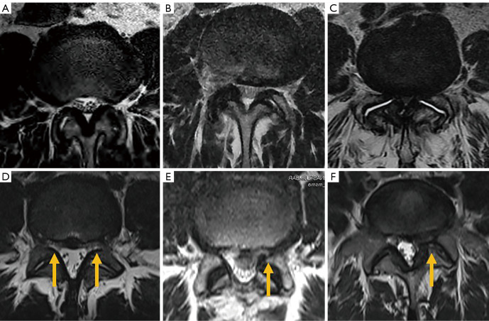 Figure 17