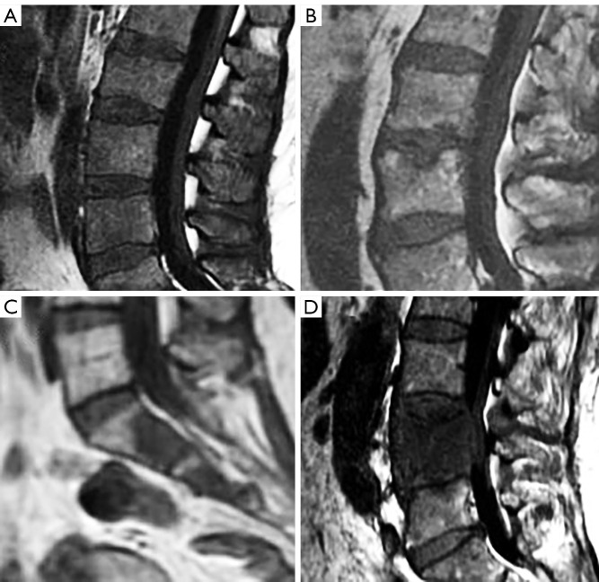 Figure 34