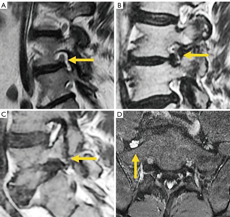 Figure 18