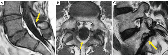 Figure 22