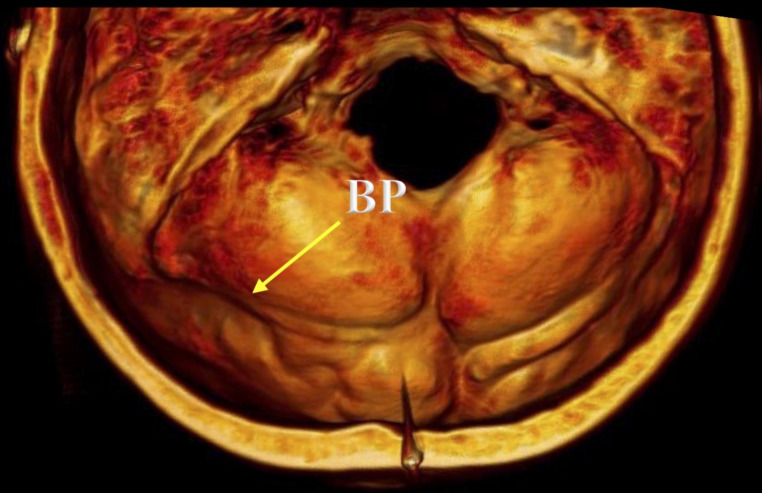 Fig. 7