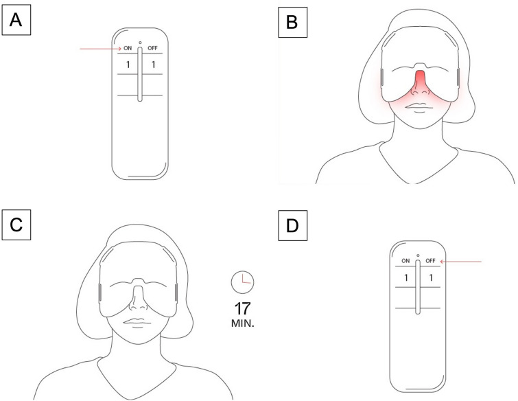 Fig. 3