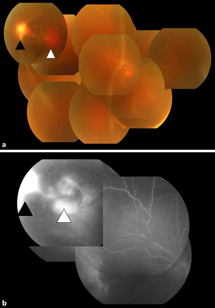 Fig. 1