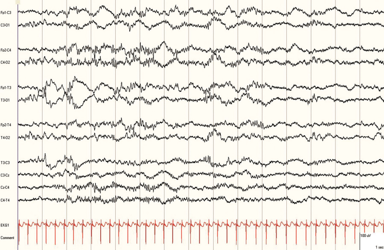 Fig.4