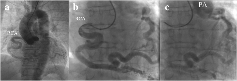 Fig. 2