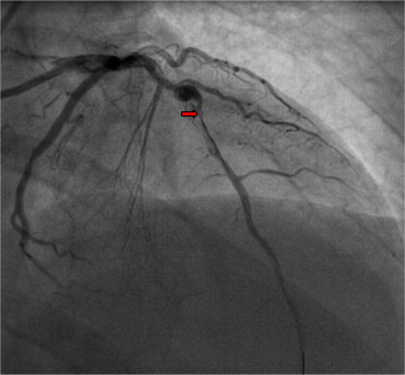 Fig. 2