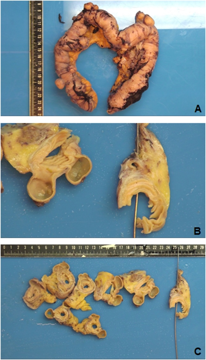 Fig. 2