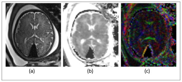 Figure 14