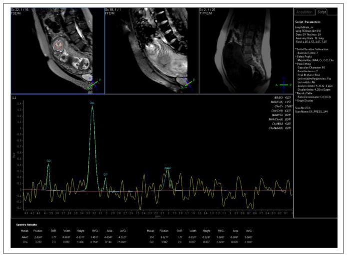 Figure 15