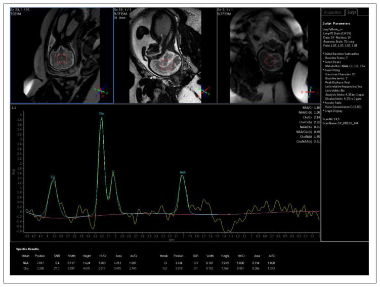 Figure 16