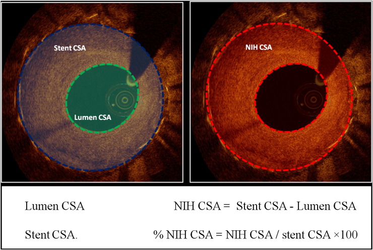 Fig. 1