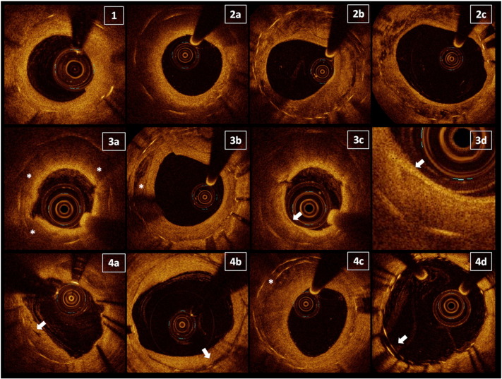 Fig. 2