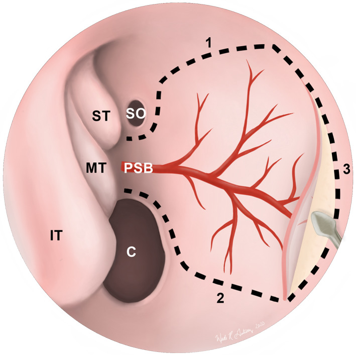 FIGURE 4