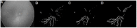 Fig 12