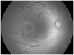 Fig 14