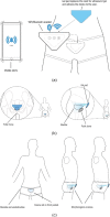 Fig. 17