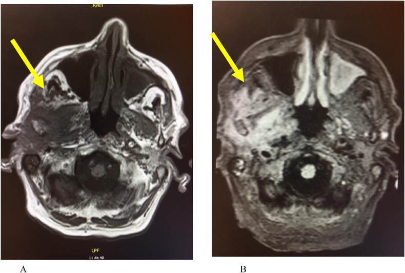 Fig. 5