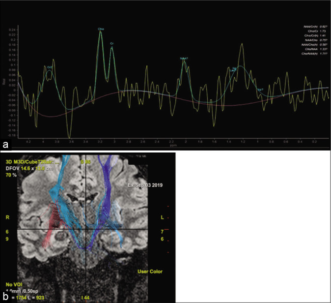 Figure 2: