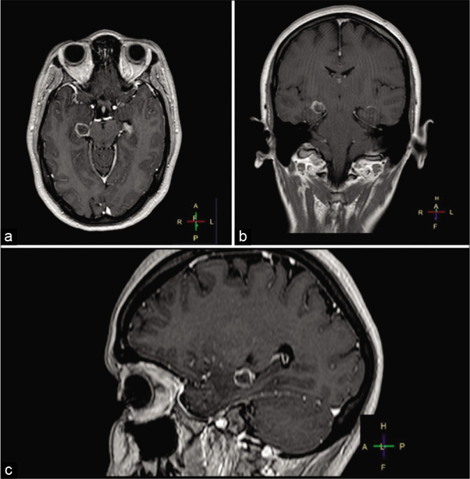 Figure 1: