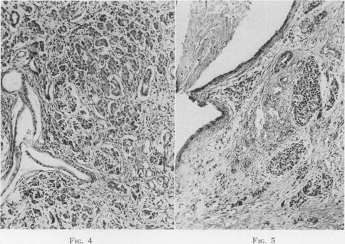 Fig. 4., Fig. 5.