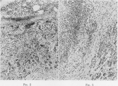 Fig. 2., Fig. 3.