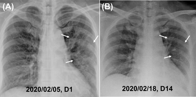 Fig. 1