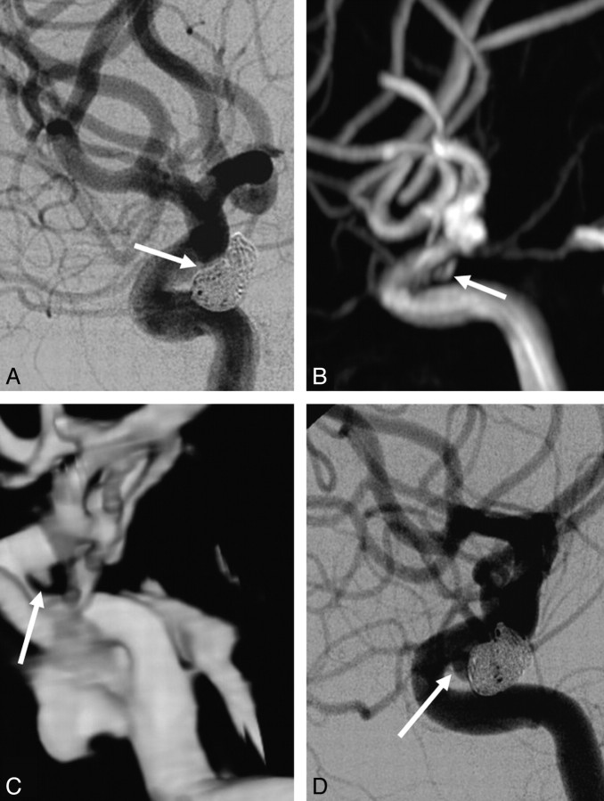 Fig 4.