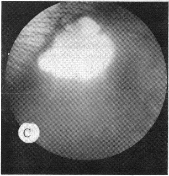 FIGURE 27 C