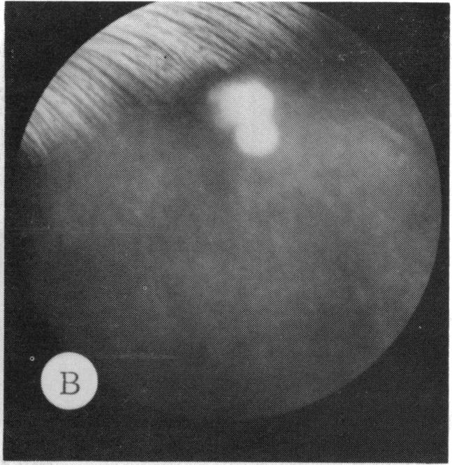 FIGURE 27 B