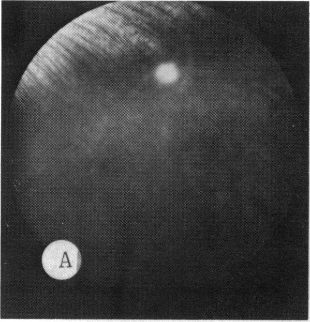 FIGURE 27 A