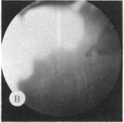 FIGURE 25 B