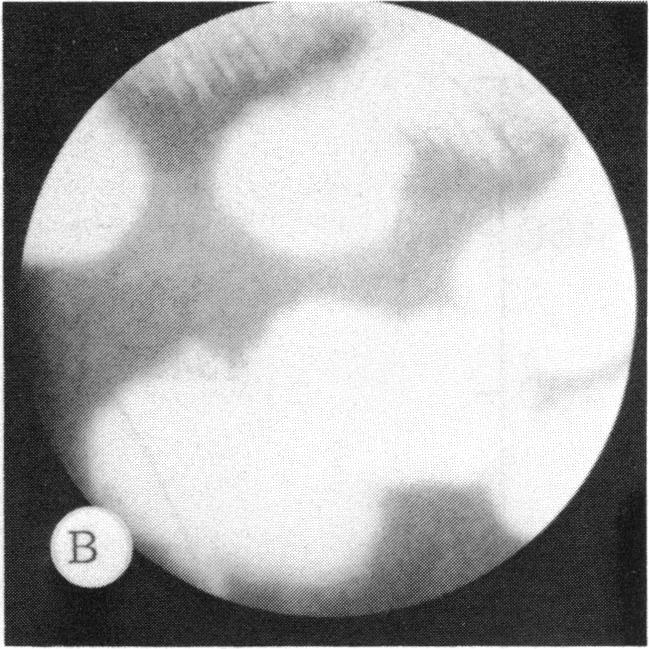 FIGURE 29 B