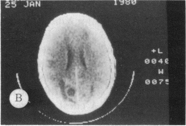 FIGURE 4 B