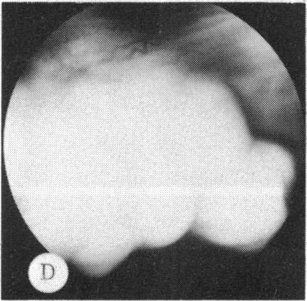 FIGURE 25 D