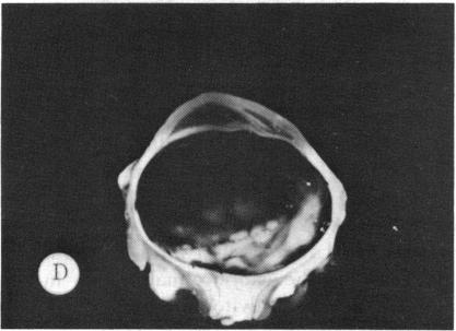 FIGURE 22 D