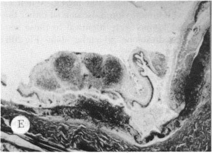 FIGURE 21 E