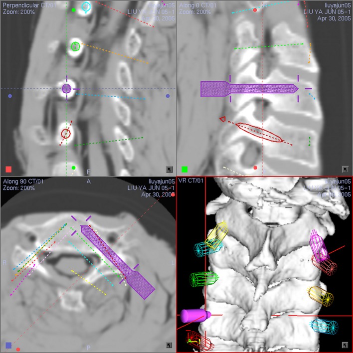 Fig. 2