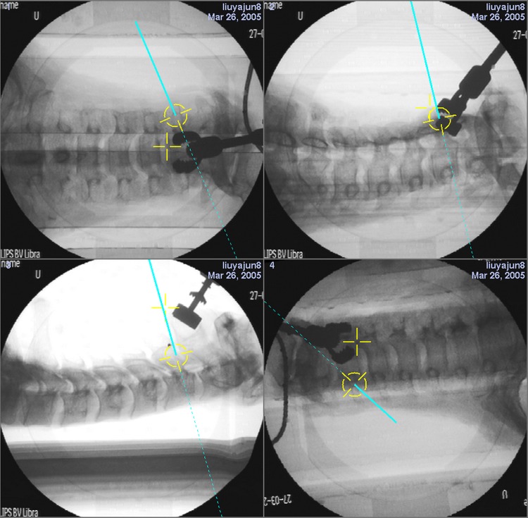 Fig. 1