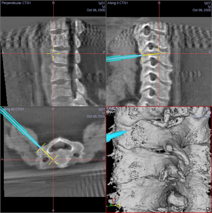 Fig. 4